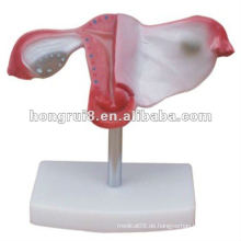 ISO 2012 Natürliche Größe Uterus Modell HR-436, künstliche Abtreibung simuliert Uterus-Modell
